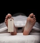 Body on embalming table