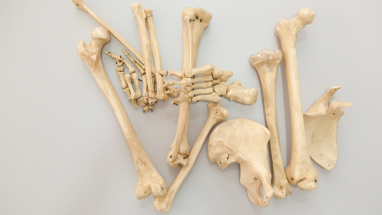 Bones